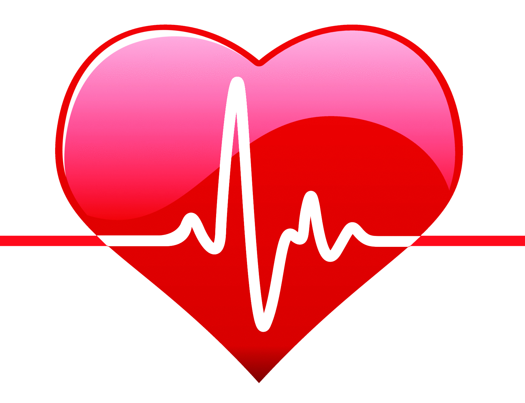 ECG Heart Rate.