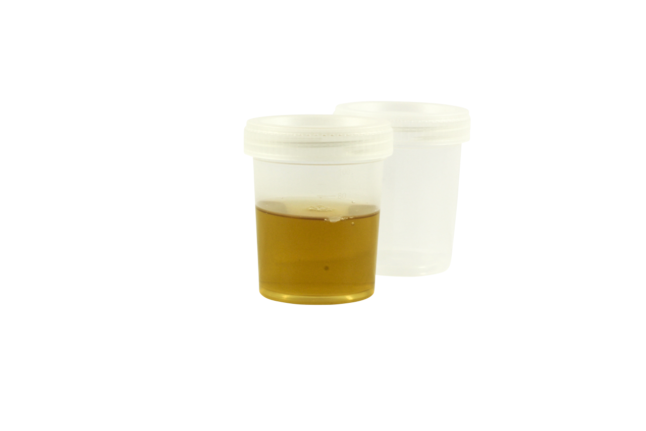 Test Tube PNG Image PurePNG Free transparent CC0 PNG Image Library