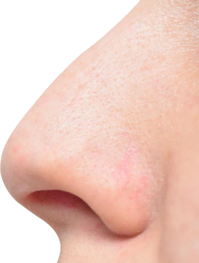 Human Nose